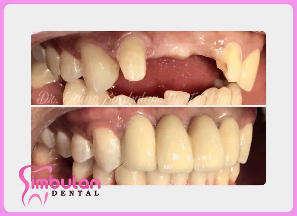 Prostho-2023 (1)