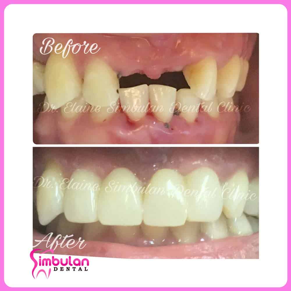 Prostho-2023 (10)