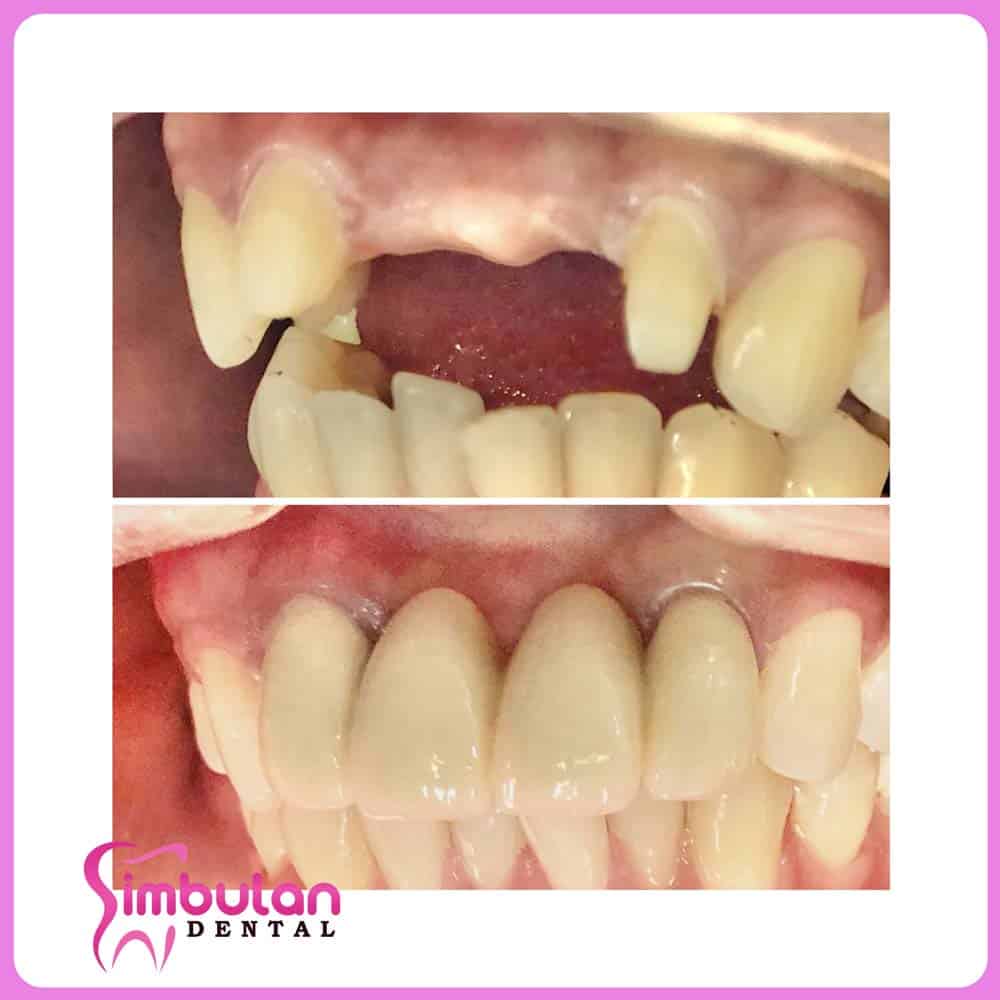 Prostho-2023 (2)