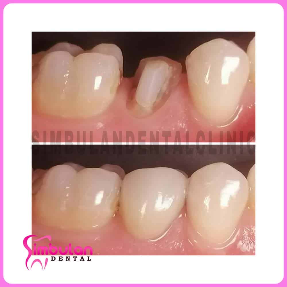 Prostho-2023 (3)