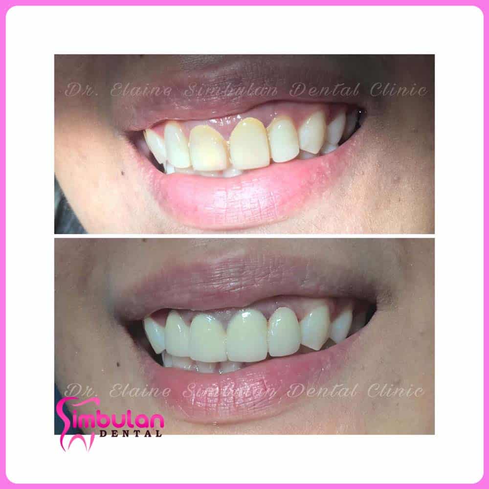 Prostho-2023 (4)