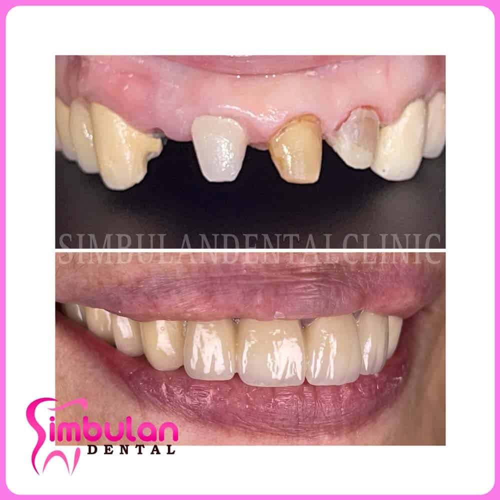 Prostho-2023 (5)