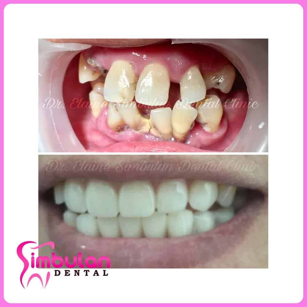 Prostho-2023 (6)