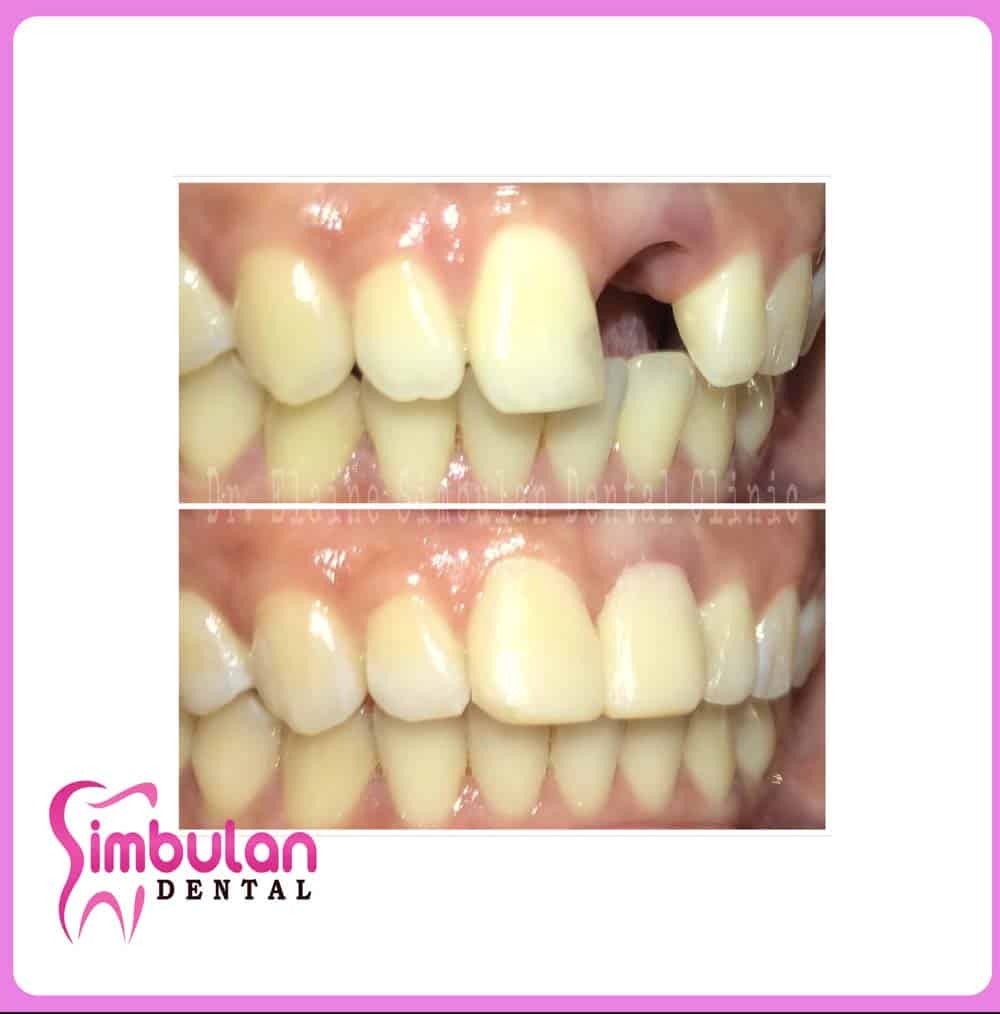 Prostho-2023 (7)