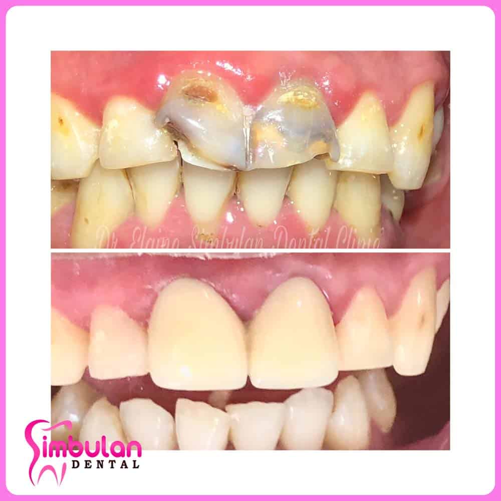 Prostho-2023 (8)