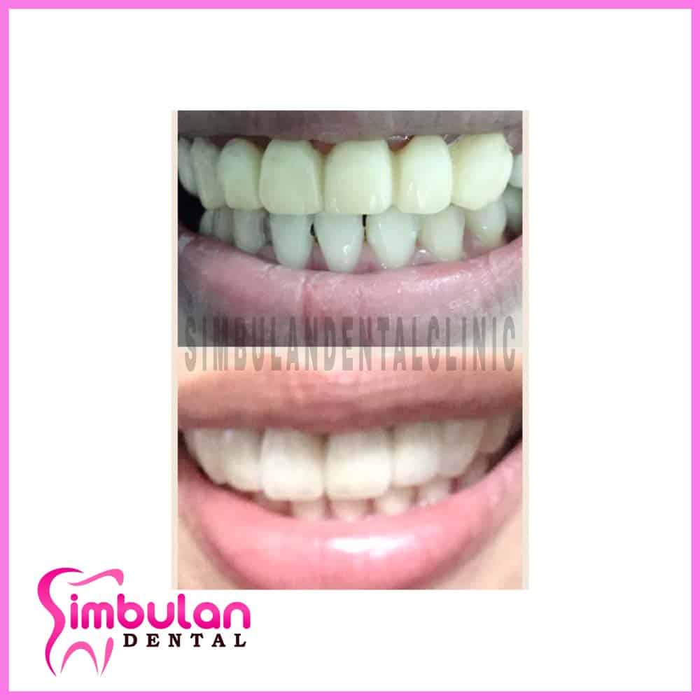 Prostho-2023 (9)